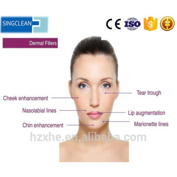 Singfiller Anti-Wrinkles Hyaluronate Acid Injection Dermal Filler+Breast Enhancement